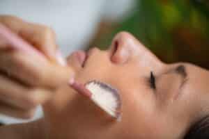 Woman undergoing TCA chemical peel treatment, a skin rejuvenation procedure known for its exfoliating and anti-aging benefits
